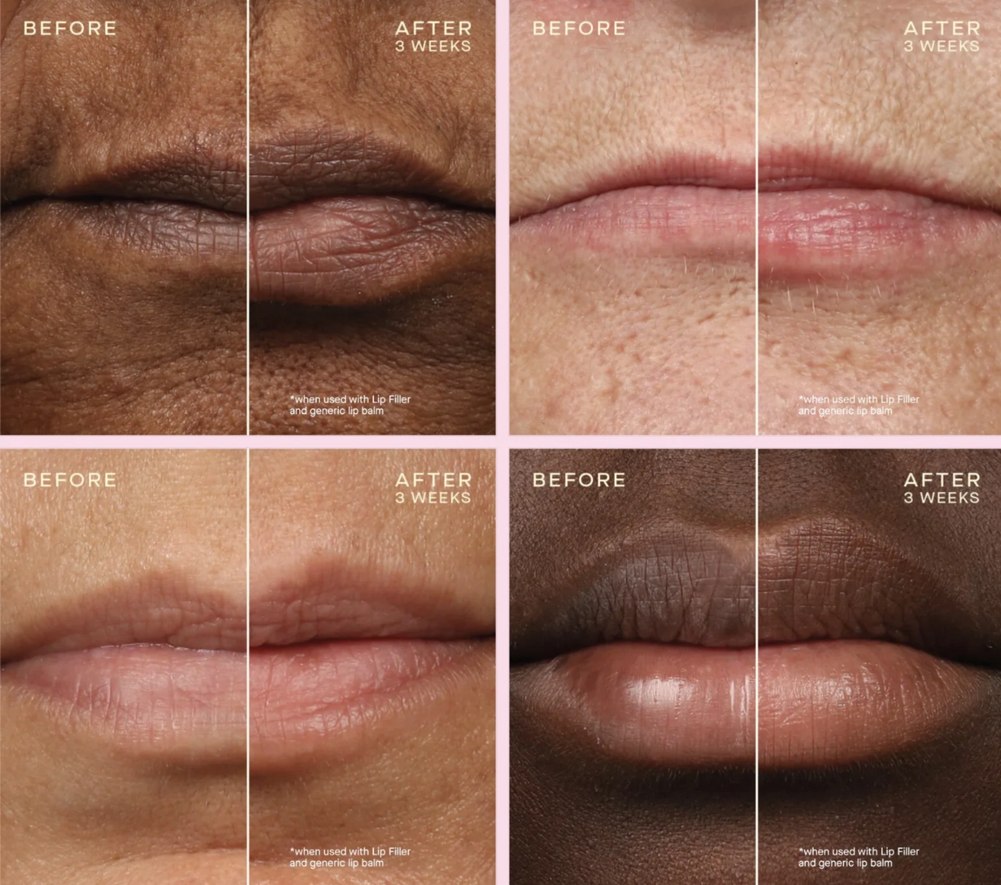 Replenishing Lip Filler + Refill 1.7ML