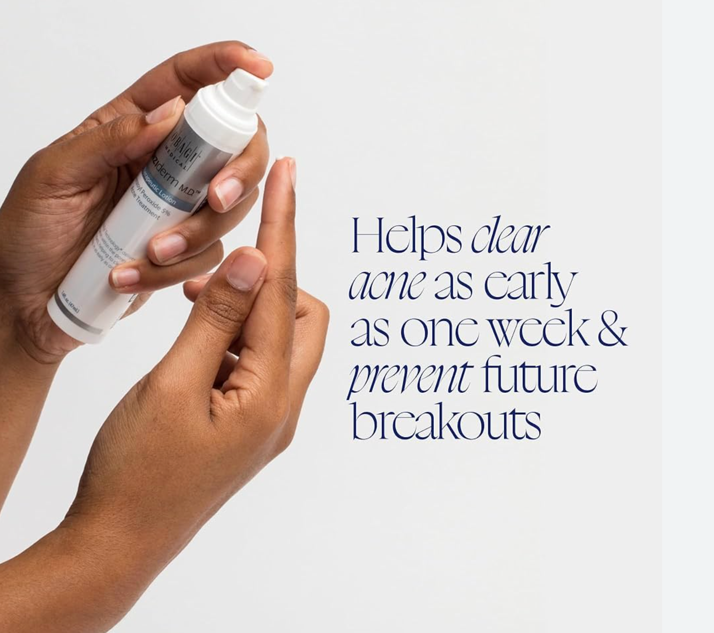 CLENZIderm Therapeautic Lotion Benzoyl Peroxide 5%