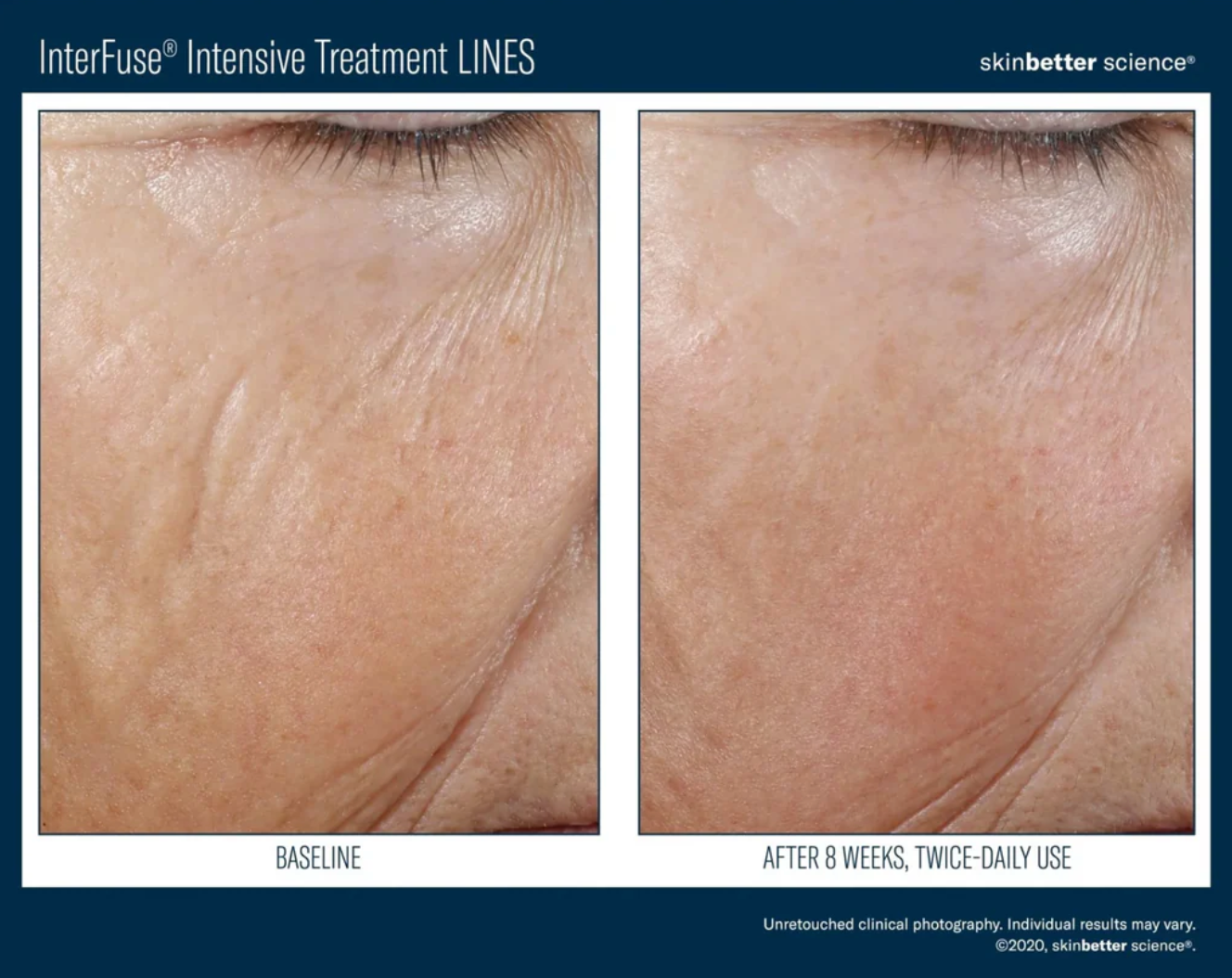 InterFuse Intensive Treatment 15mL